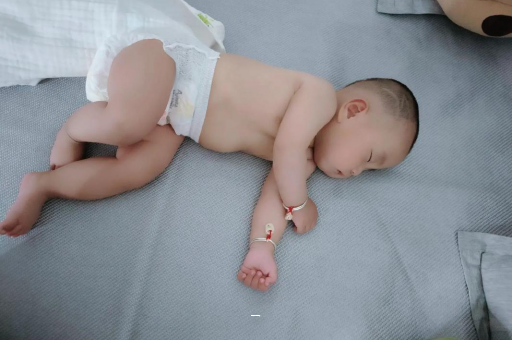 高安宝宝脸上有白色斑块